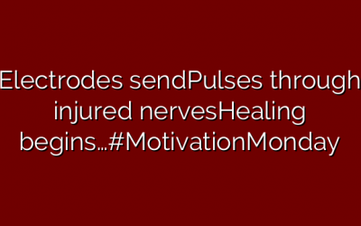 Electrodes sendPulses through injured nervesHealing begins…#MotivationMonday