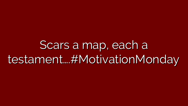 Scars a map, each a testament….#MotivationMonday